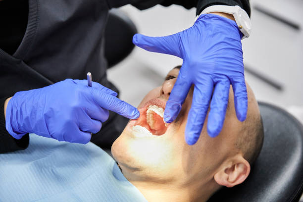 Best Broken Tooth Emergency  in Barneveld, WI